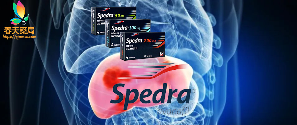 賽倍達Spedra,, 美納裏尼賽倍達, 賽倍達, 賽倍達 Spedra, 賽倍達ptt, 賽倍達價格, 賽倍達副作用, 賽倍達劑量, 賽倍達原廠, 賽倍達台灣, 賽倍達吃法, 賽倍達哪裡買